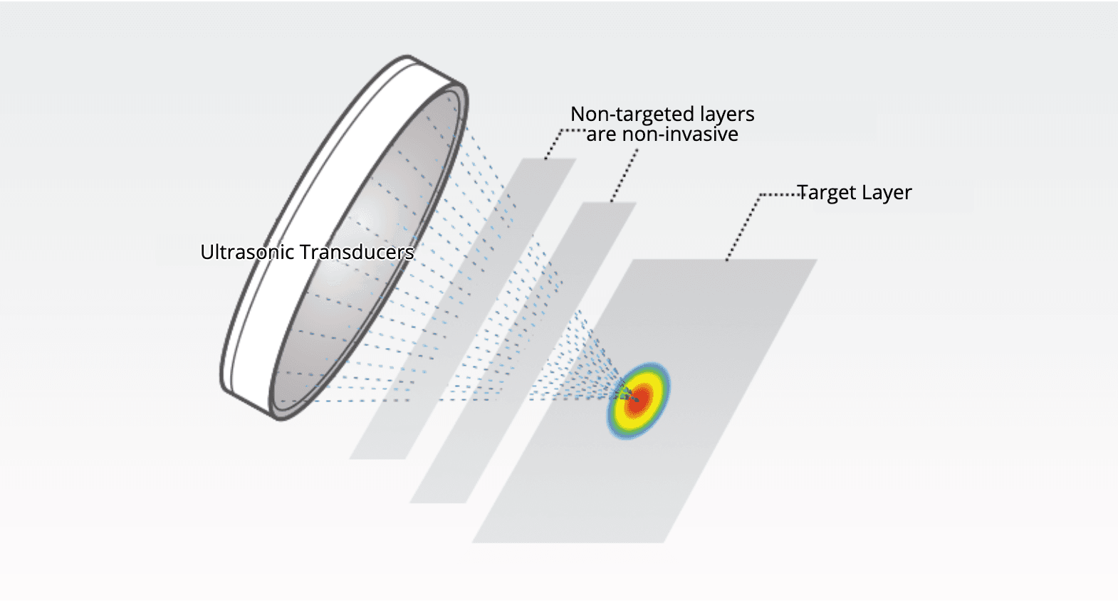 ultracel-q-core-technology