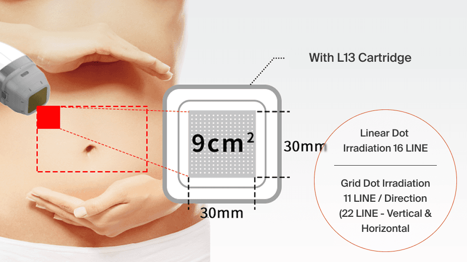 ultracel-q-core-technology